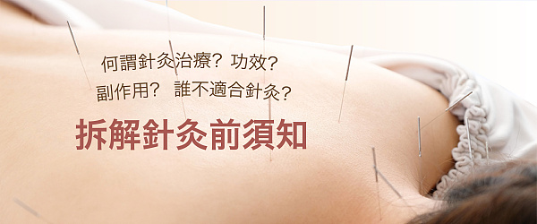 【針灸好痛唔敢試?】至 hit 針灸減肥美容療程,一文同你睇清針灸治療功效、副作用同注意事項